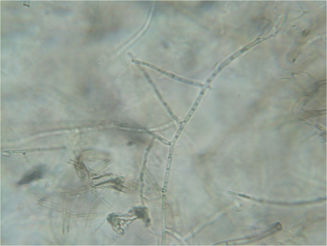 Rhizoctonia Solani